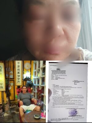 Diduga Jadi Korban Penganiayaan, Diana Laporkan Kasus ke Polres Metro Jakarta